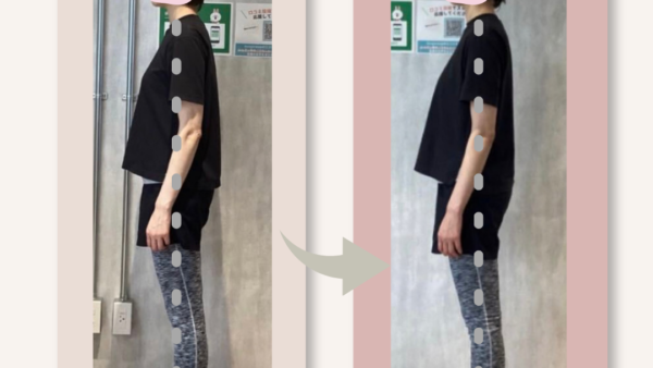 Before→After①